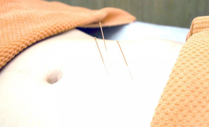Acupuntura en Castelldefels Acupuntura en Castelldefels